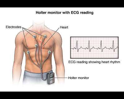 ECG Test